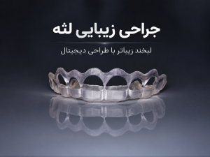 جراحی زیبایی لثه با طراحی دیجیتال و گاید جراحی در کلینیک دکتر میمنت