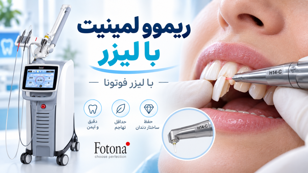 ریموو لمینیت با لیزر