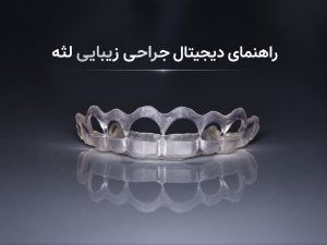 راهنمای دیجیتال جراحی زیبایی لثه برای اصلاح دقیق خط لثه و استخوان